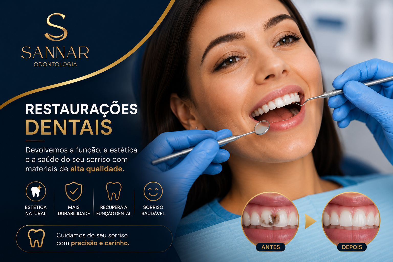 Restaurações dentárias